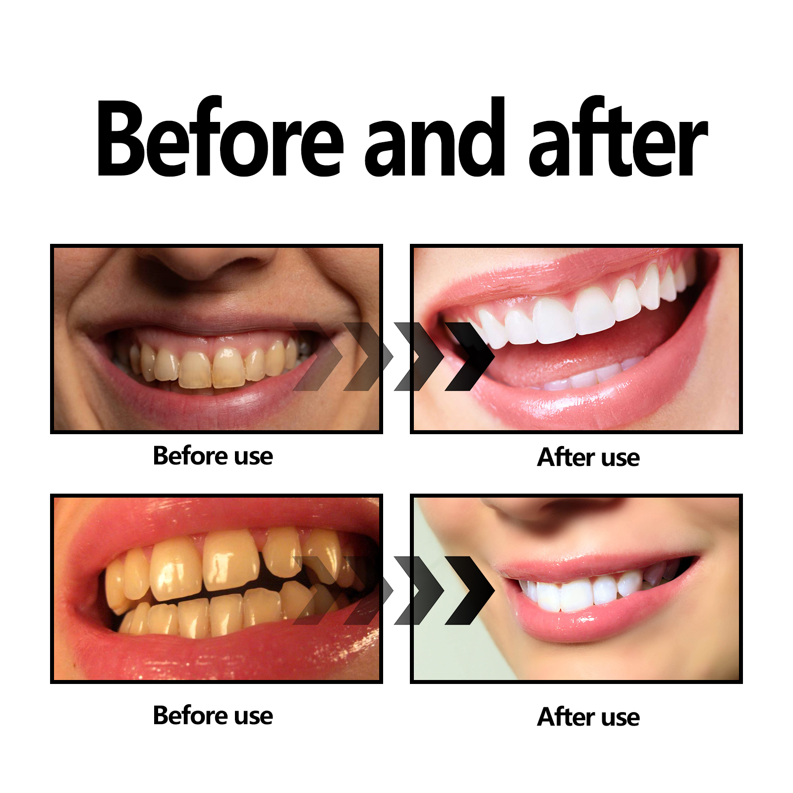 Activated Coconut Charcoal Too - Teeth Whitening With Coconut Oil 评论和价格