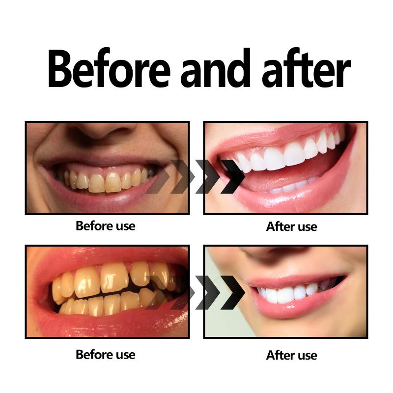 Teeth Whitening Powder Charcoa - Teeth Whitening With Baking Soda 评论和价格