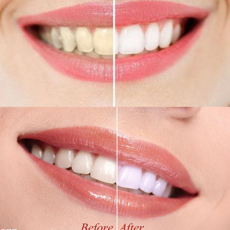 Bamboo Charcoal Teeth Tooth De - Teeth Whitening Hismile 评论和价格