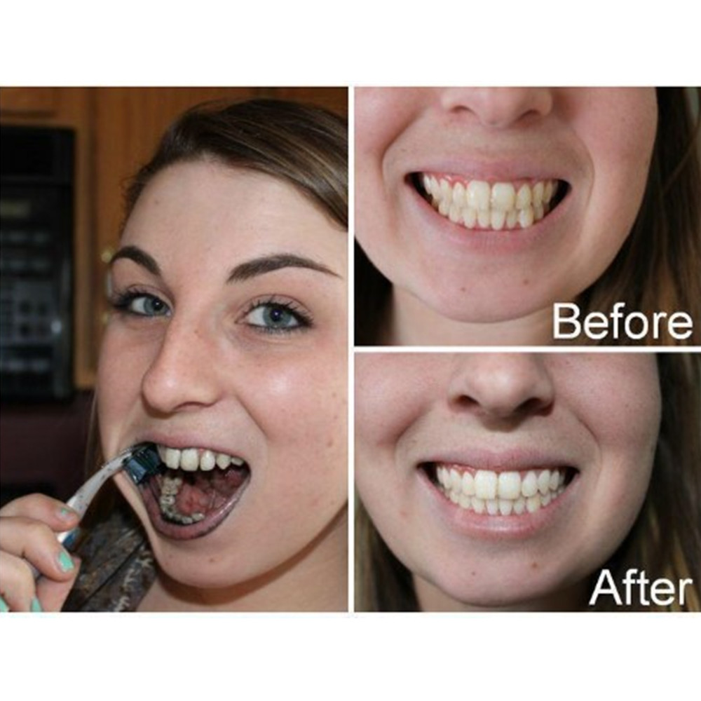 Bamboo Charcoal Teeth Tooth De - Teeth Whitening Hismile 评论和价格