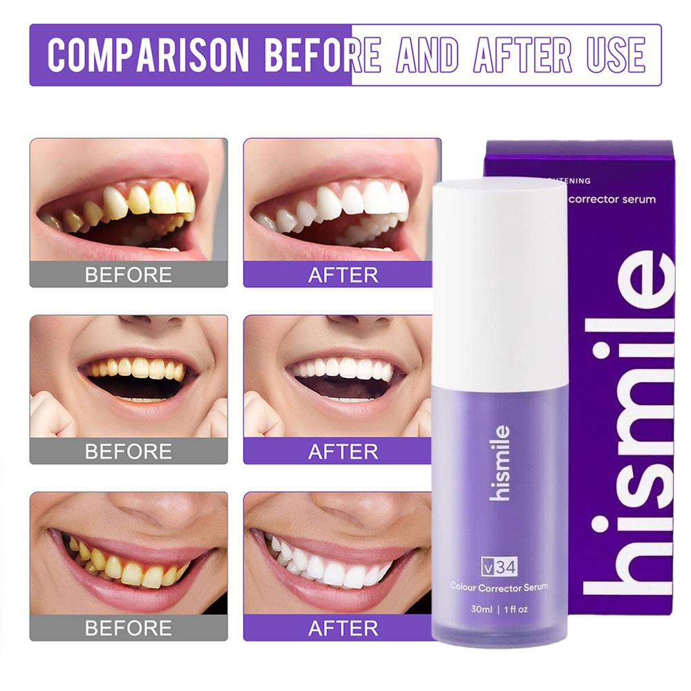 30ml Hismile V34 Purple Teeth  - Teeth Whitening Hismile 评论和价格