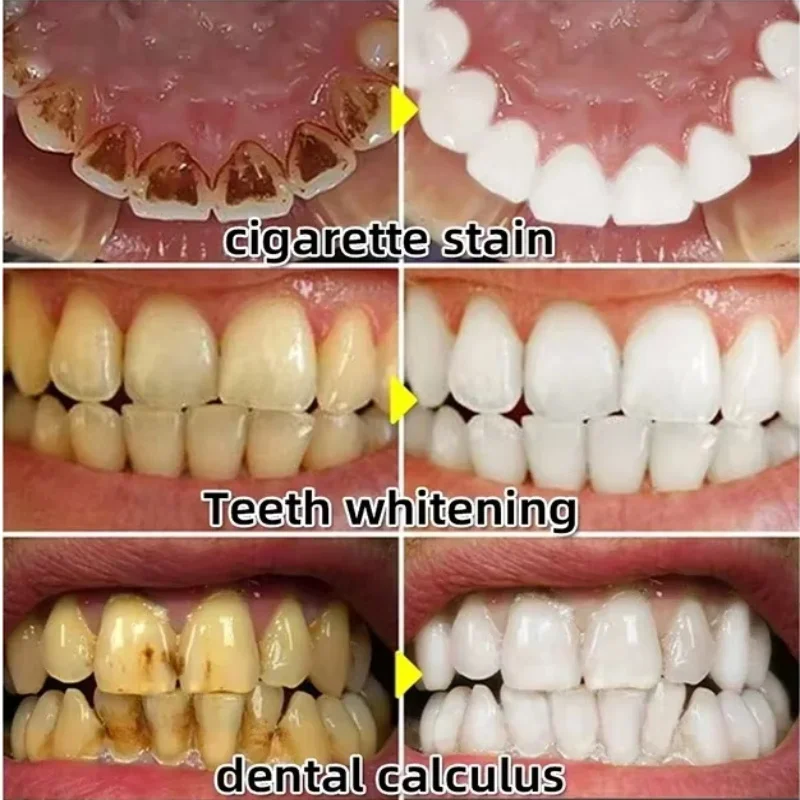 Quickly Repair Gum Serum Relie - Teeth Whitening With Baking Soda 评论和价格
