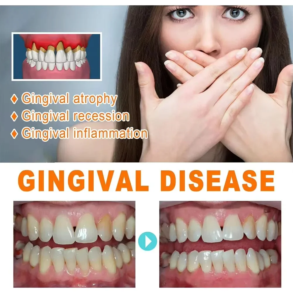 Quickly Repair Gum Serum Relie - Teeth Whitening With Baking Soda 评论和价格