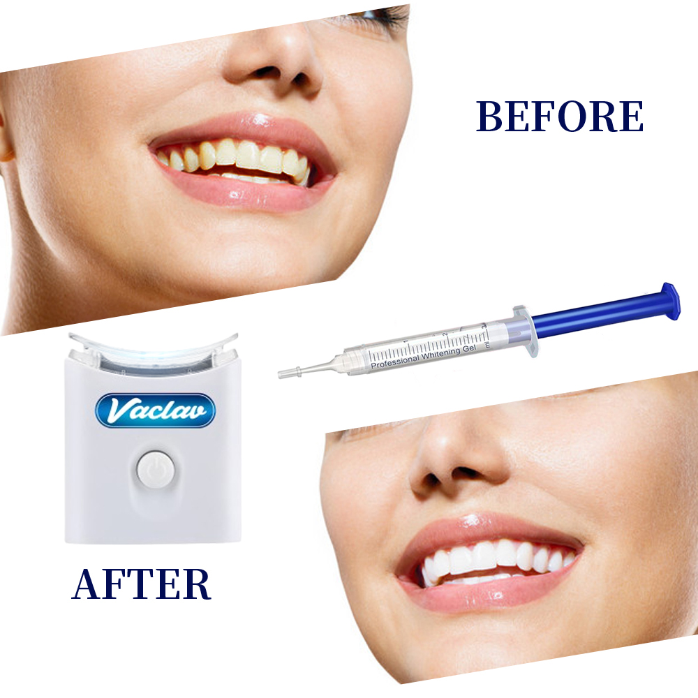 Mint Teeth Whitening Gel Syrin - Teeth Whitening With Baking Soda 评论和价格