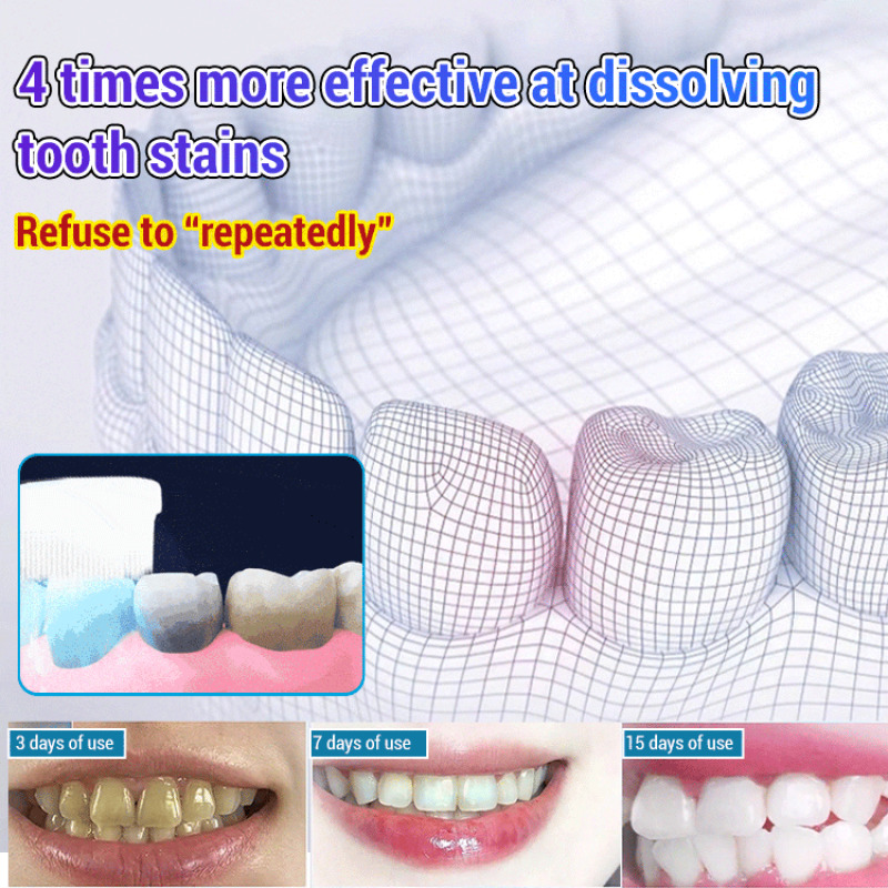Baking Soda Whiten Teeth Fresh - Teeth Whitening With Baking Soda 评论和价格