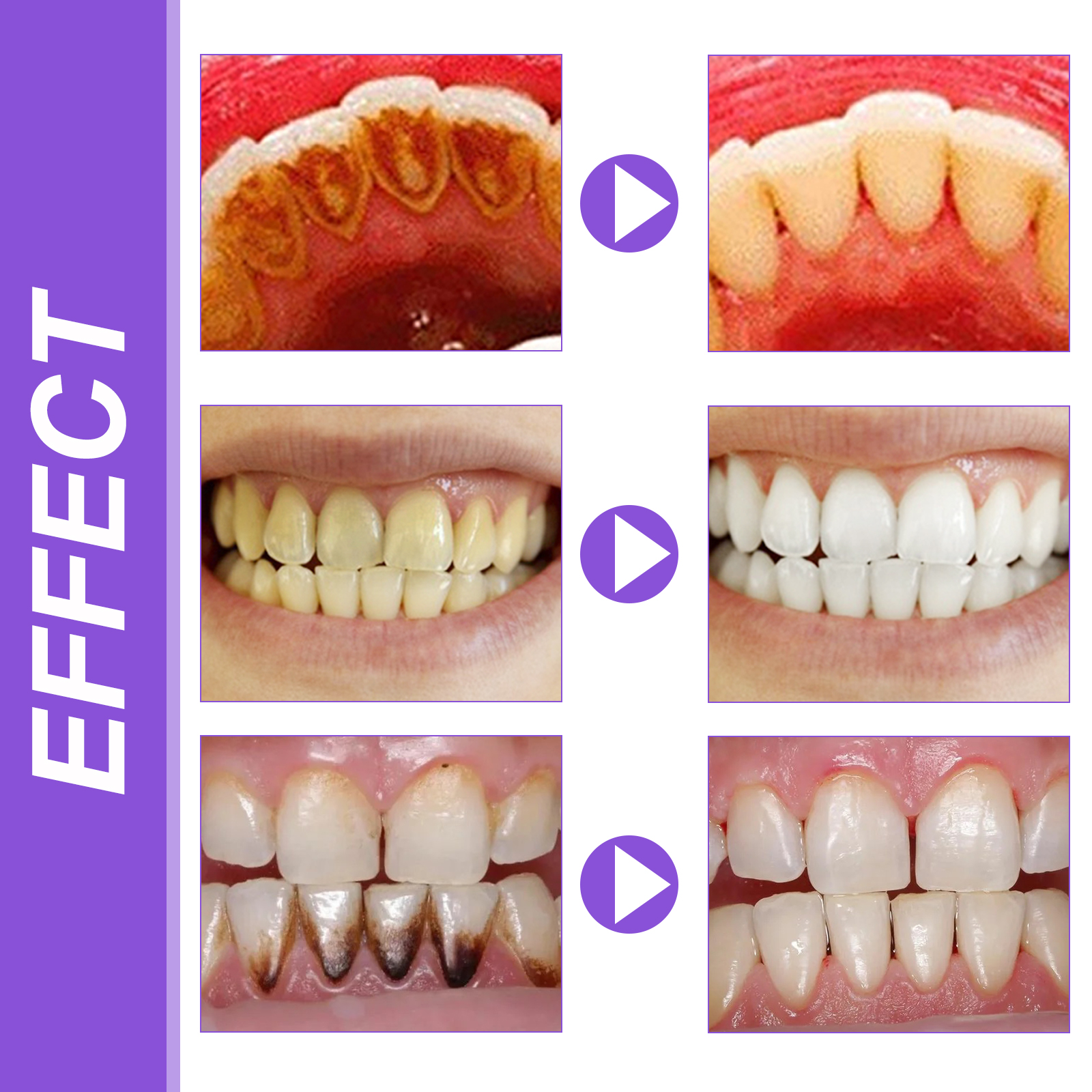 EELHOE Smiles Bright White Ref - Teeth Whitening Ingredients 评论和价格