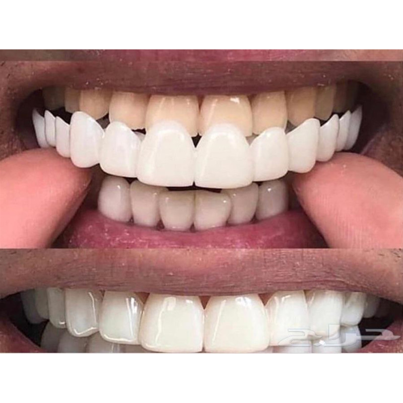 Soft Silicone Gel Dental Oral  - Teeth Whitening Moulds 评论和价格