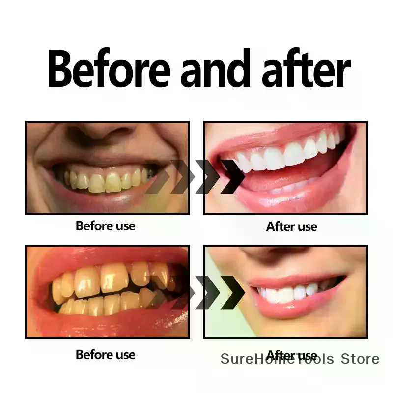 Bamboo Charcoal Powder For Tee - Teeth Whitening Ingredients 评论和价格