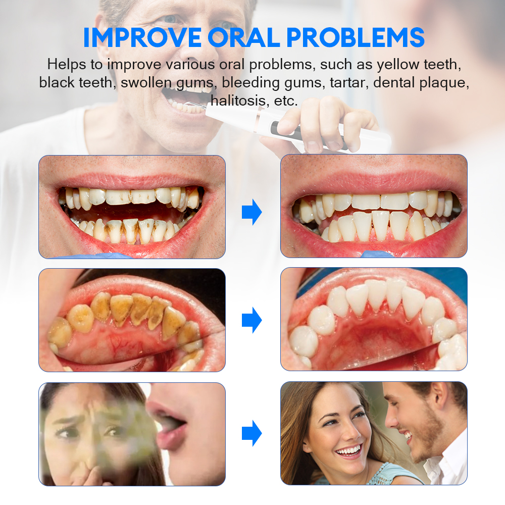 Electric Ultrasonic Dental Sca - Whitening Teeth Dentist 评论和价格