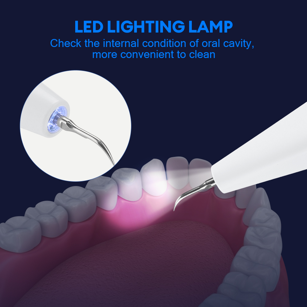 Ultrasonic Dental Calculus Rem - Whitening Teeth Dentist 评论和价格
