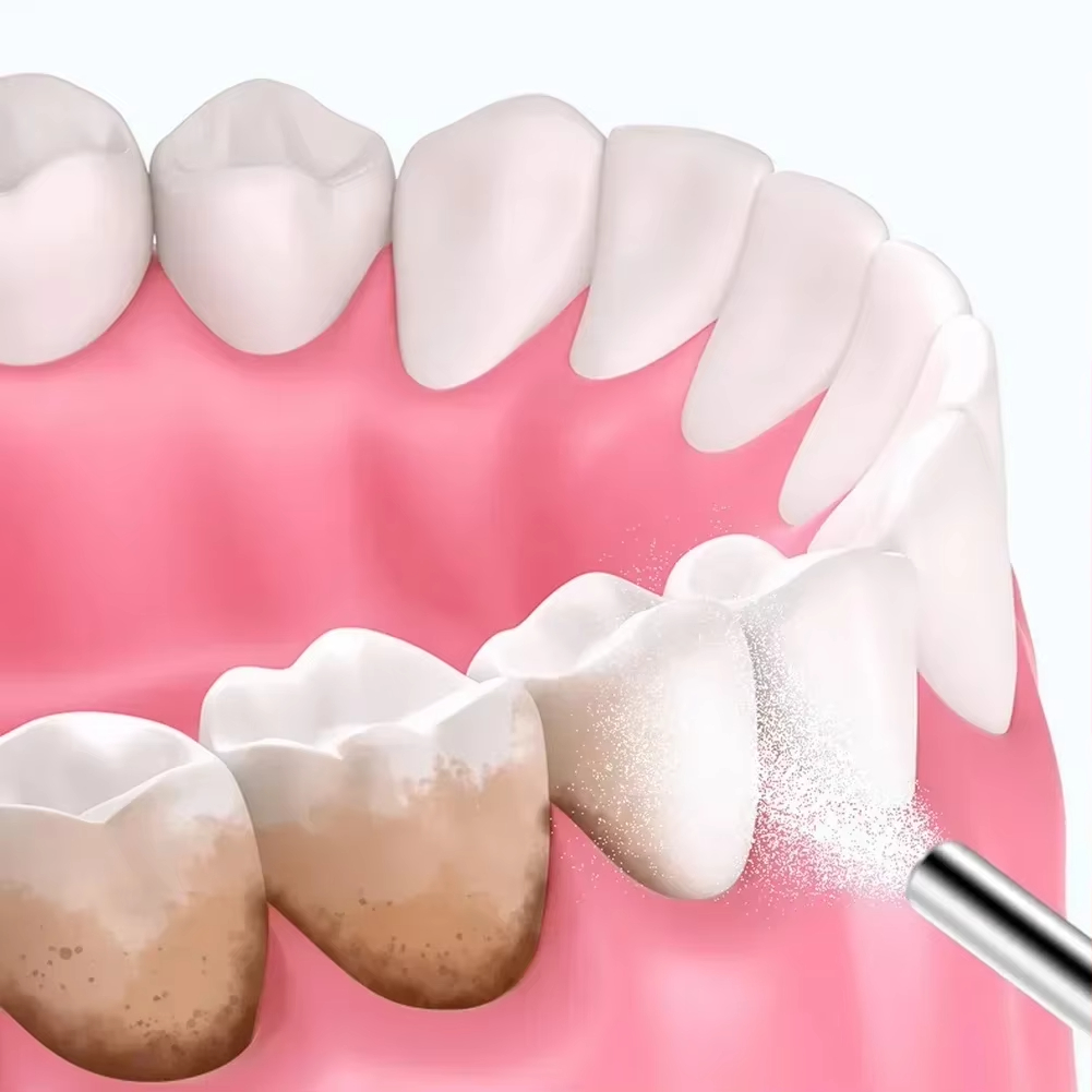 Dental Sandblasting Powder 500 - Teeth Whitening Ingredients 评论和价格
