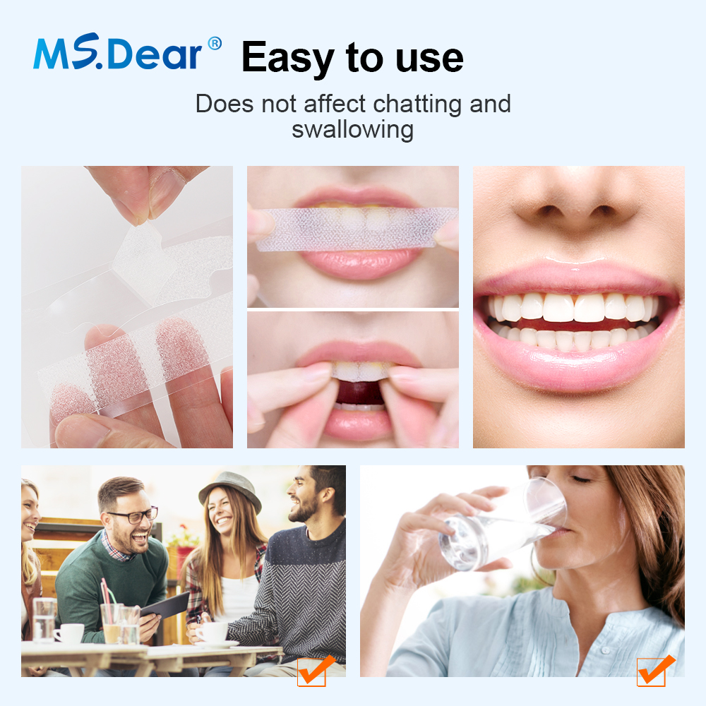 Teeth Whitening Strips Cleansi - Teeth Whitening Hismile 评论和价格